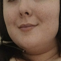 callalillybigtits Nøgen