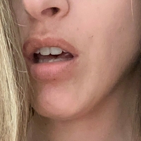 emma-skyeefree Nøgen