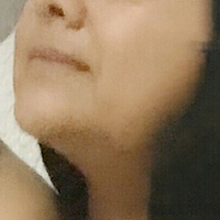 madurachichona Nøgen