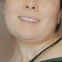 sultrylivyxo Nøgen